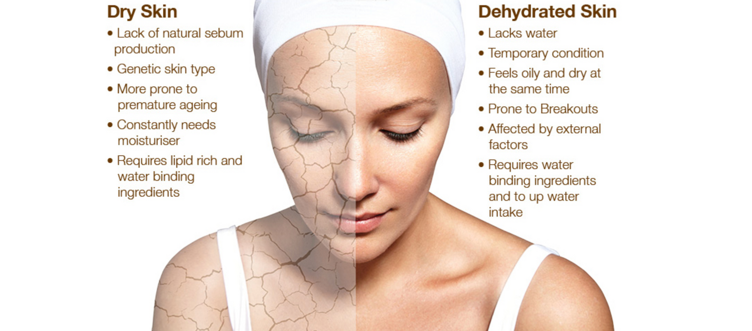 Dry Skin: The Ultimate Guide & Skin Care Routine