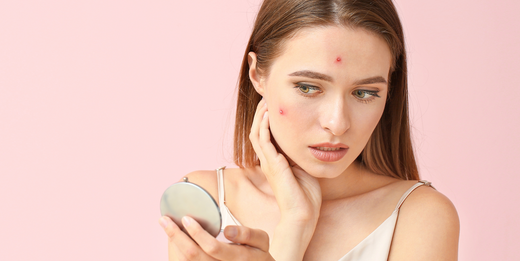 What's triggering my breakouts & how to prevent it? - blog | YEARN SKIN