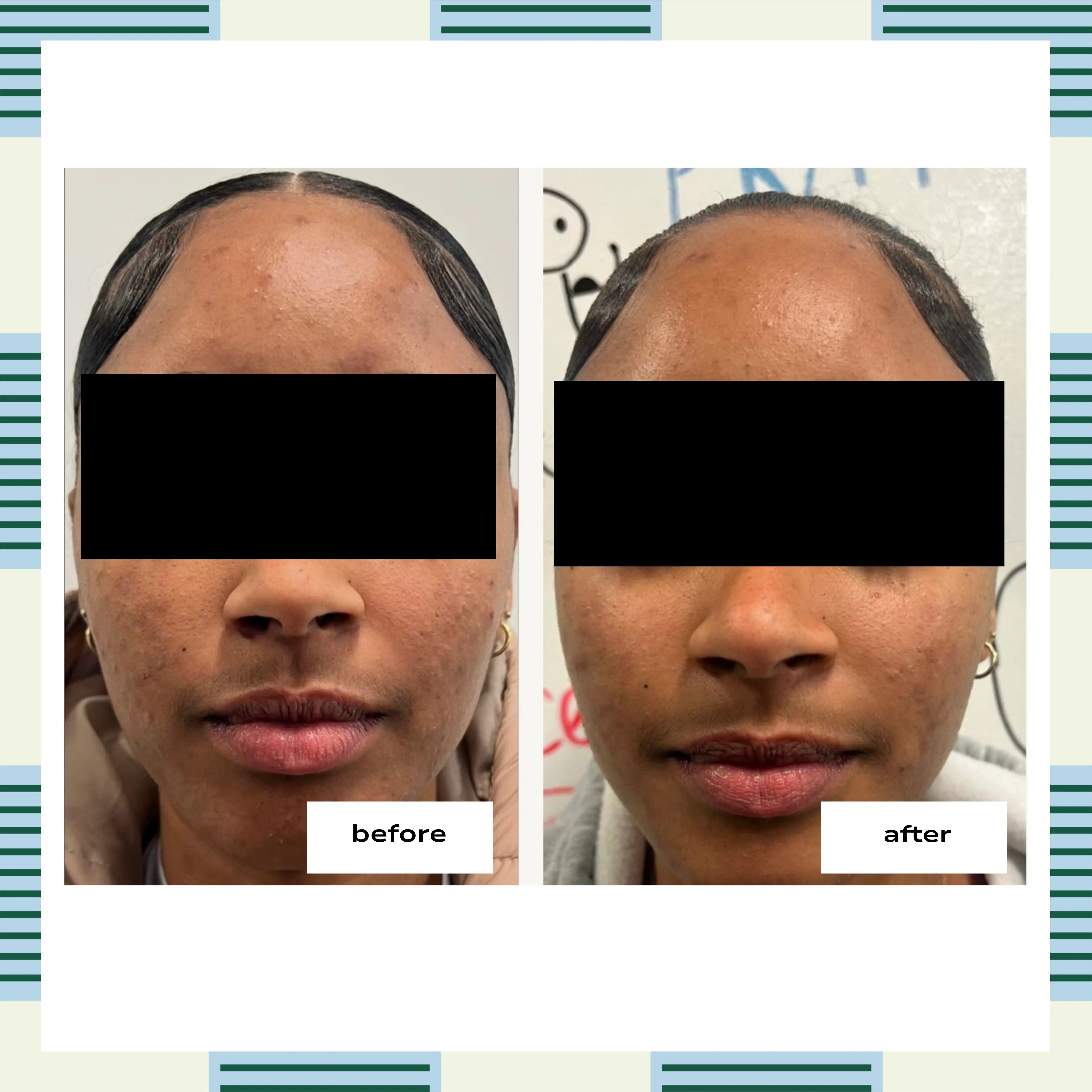 Barrier Bright Kit | 3-Step Facial Kit