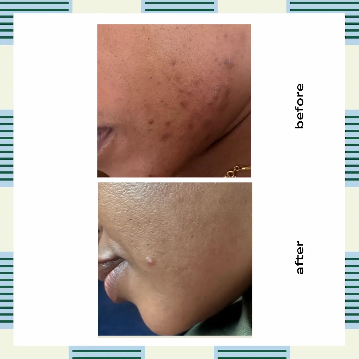 Advanced Brightening Serum, 30 ml