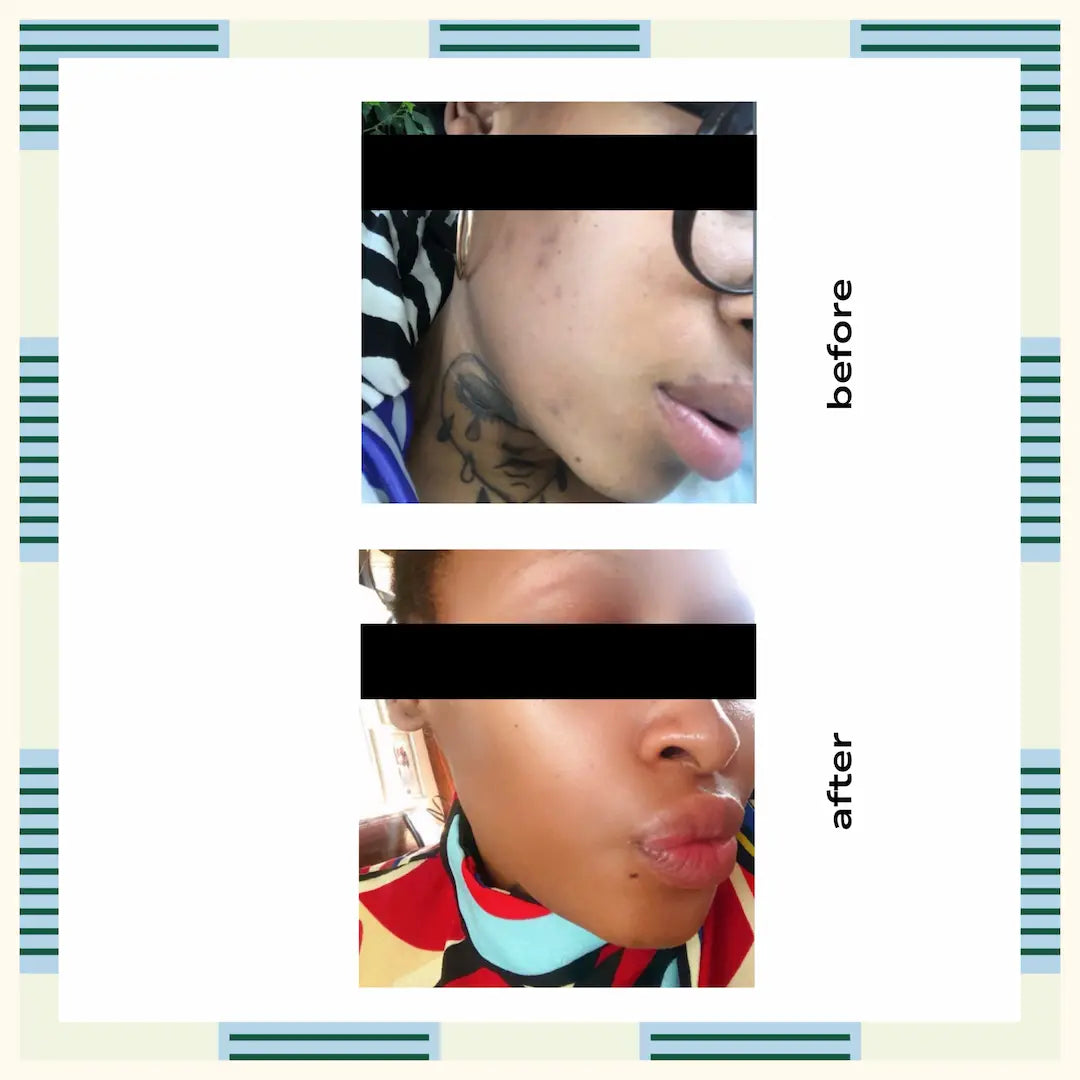 Glow Turmeric Brightening Mask, 30 ml