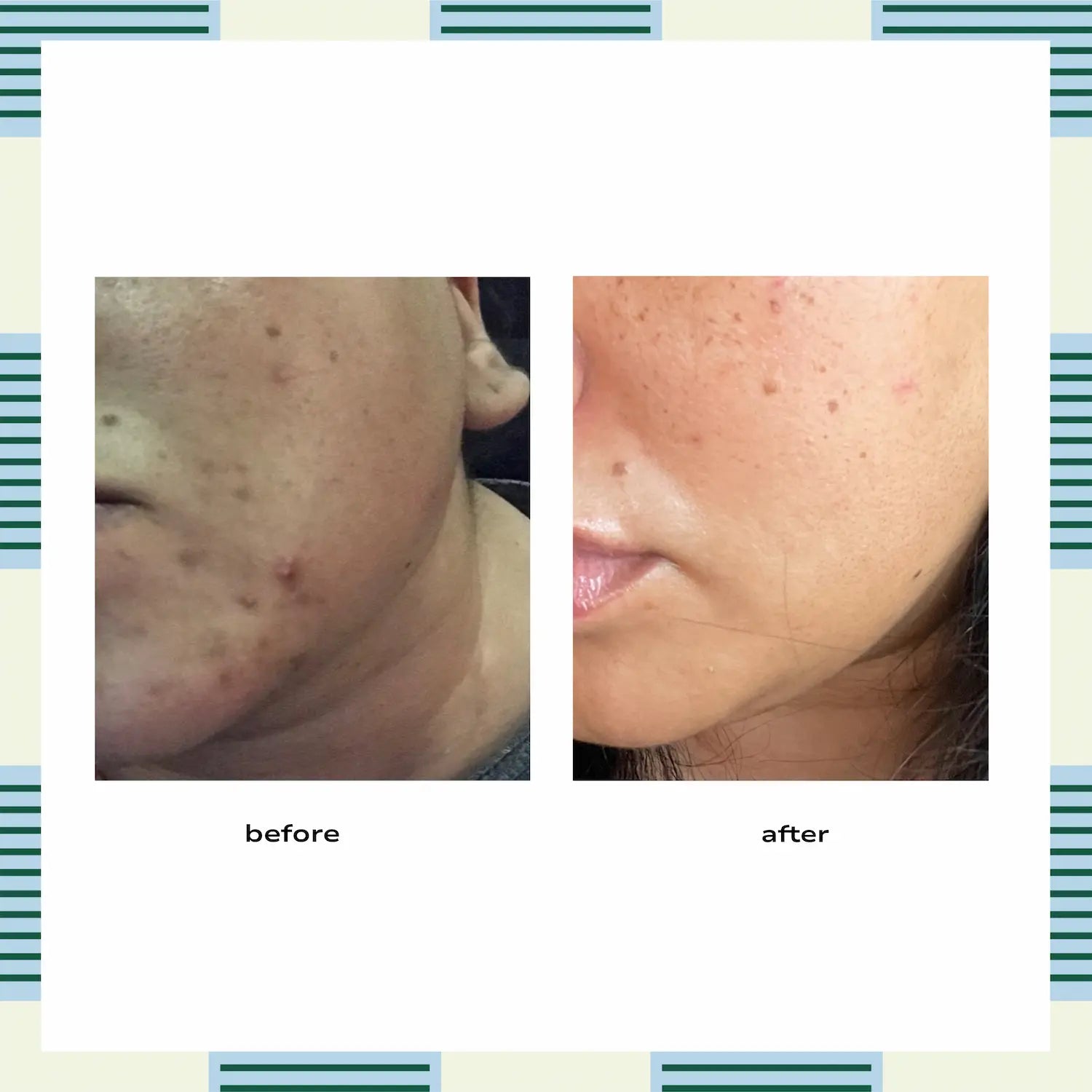 Niacinamide and Turmeric Brightening Cream, 50 ml