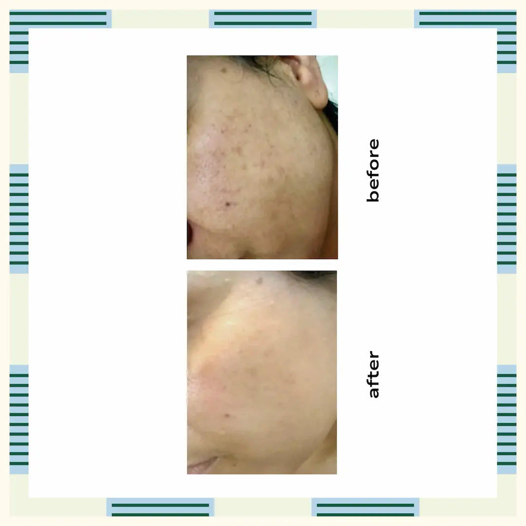 Retinol Serum, 30 ml