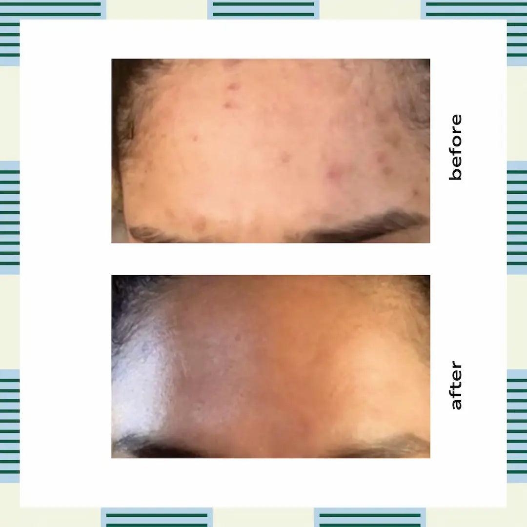 Salicylic Cleansing Gel, 120 ml