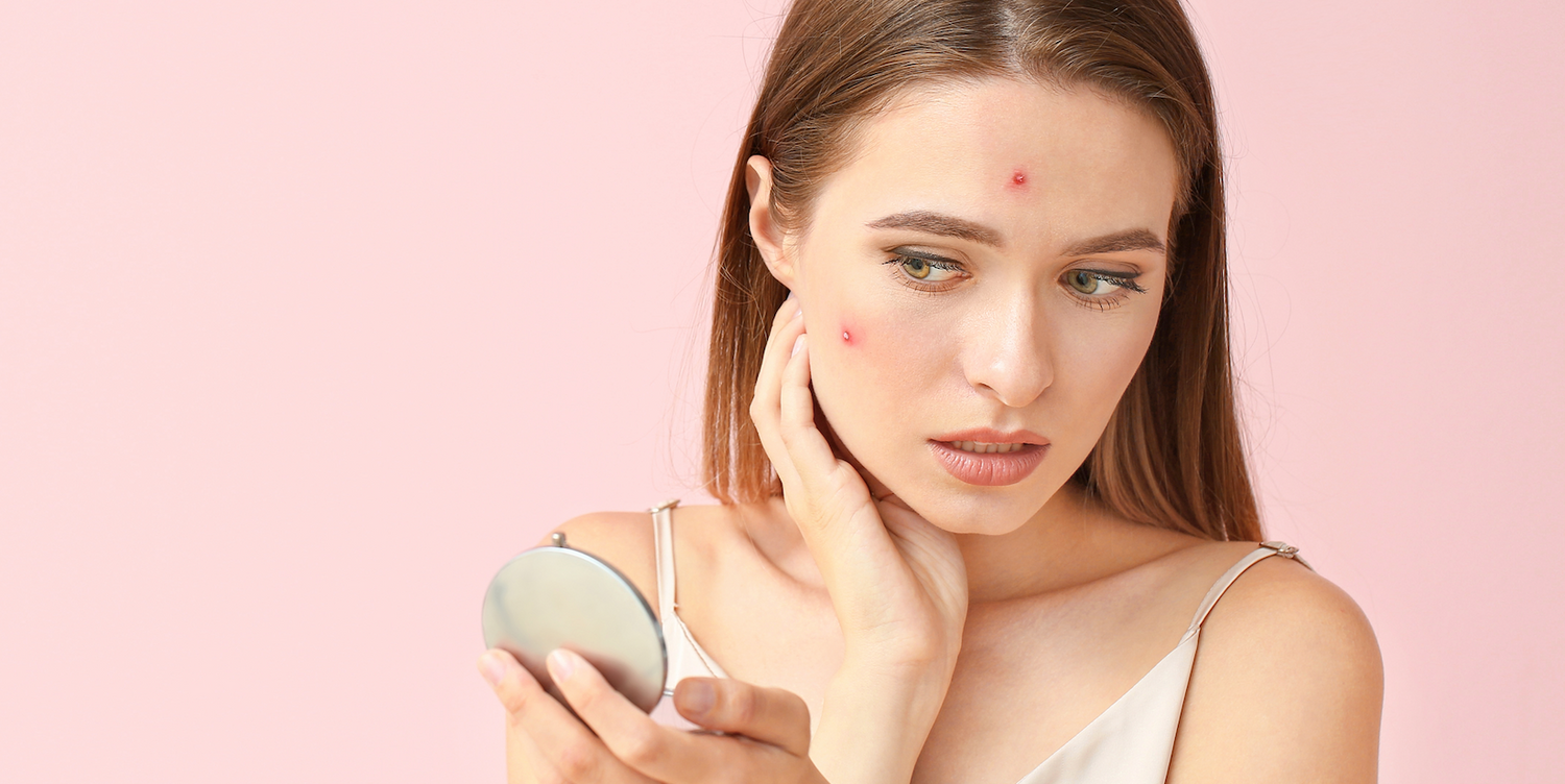 What's triggering my breakouts & how to prevent it? - blog | YEARN SKIN