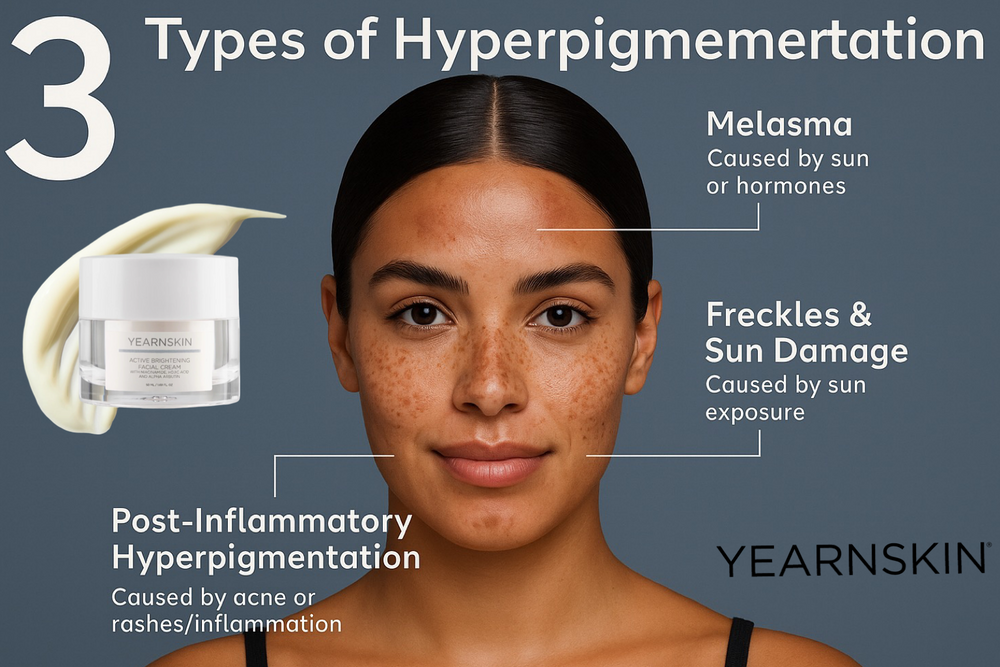 Hyperimpigmentation Skin Functional Hyperpigmentation