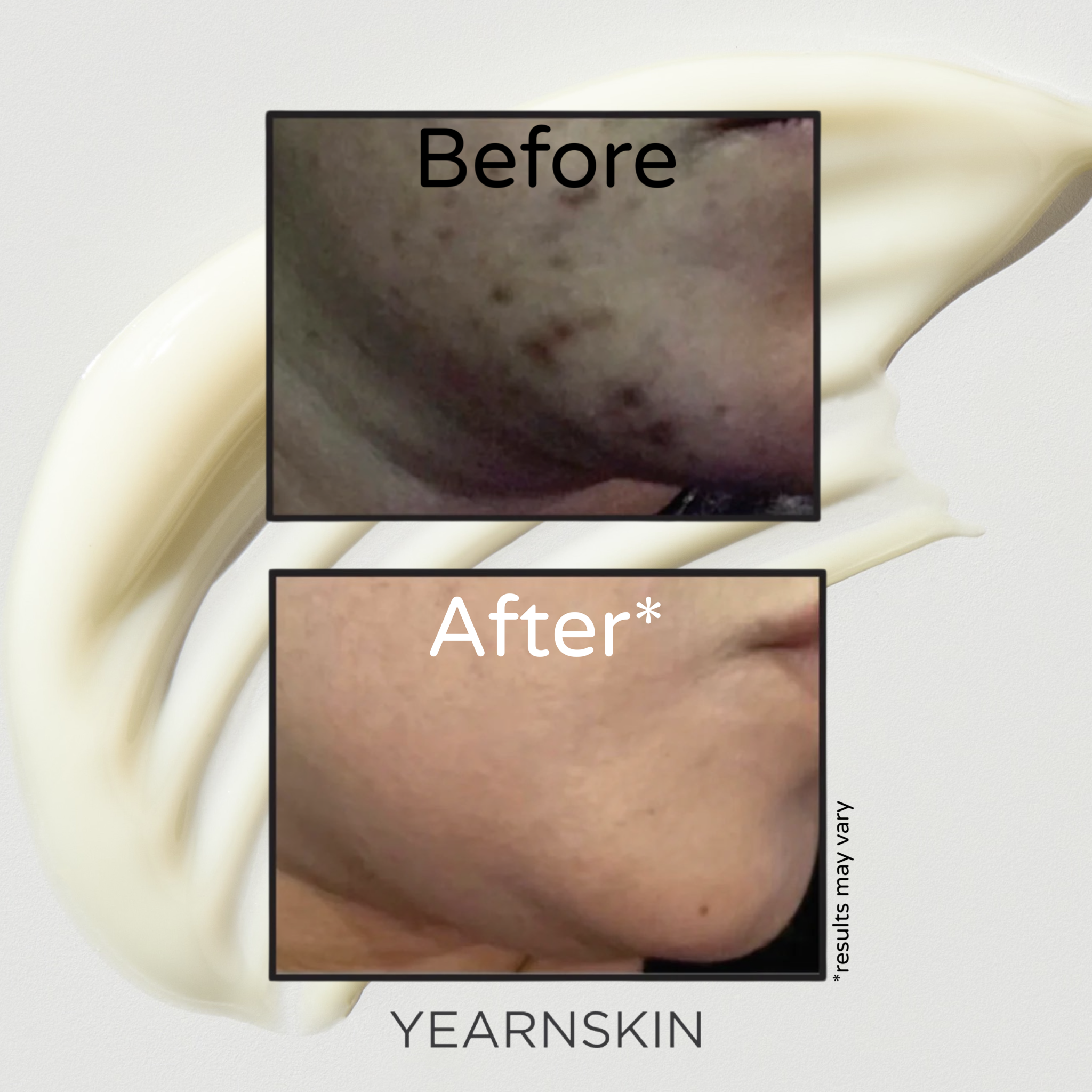 Goodbye Dark Marks Kit - Fades Dark Marks