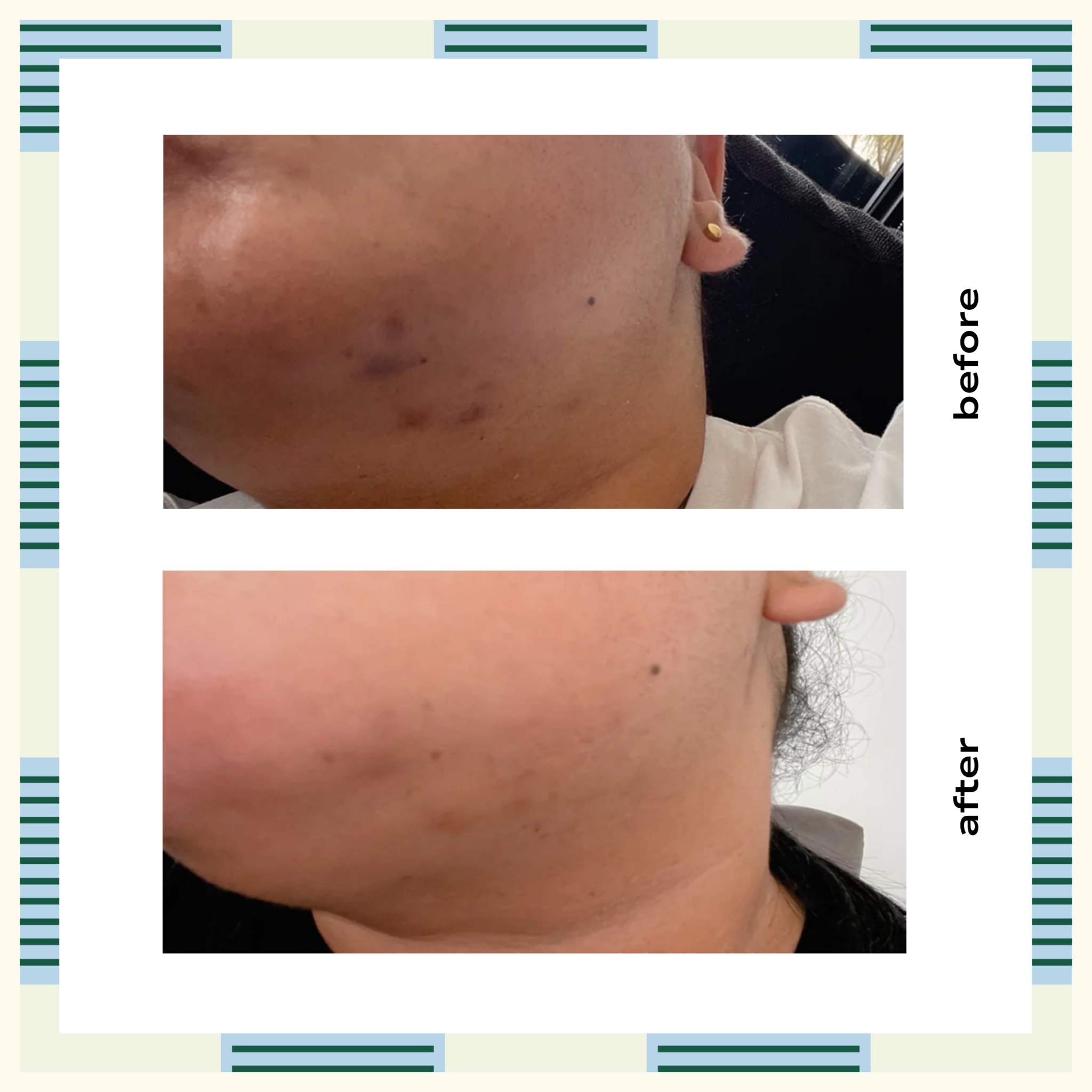 Active Brightening Facial Oil, 30 ml