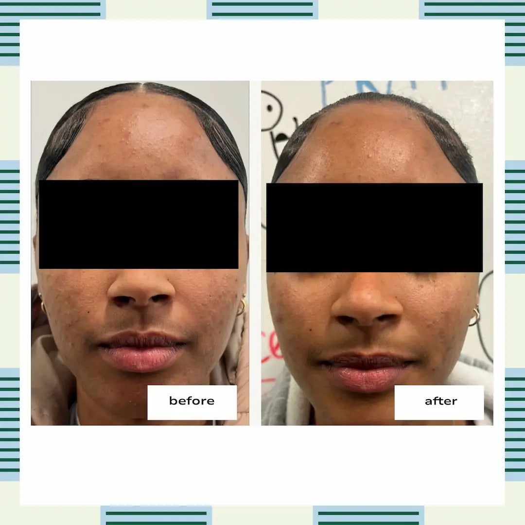 Barrier Bright Cream, 50 ml