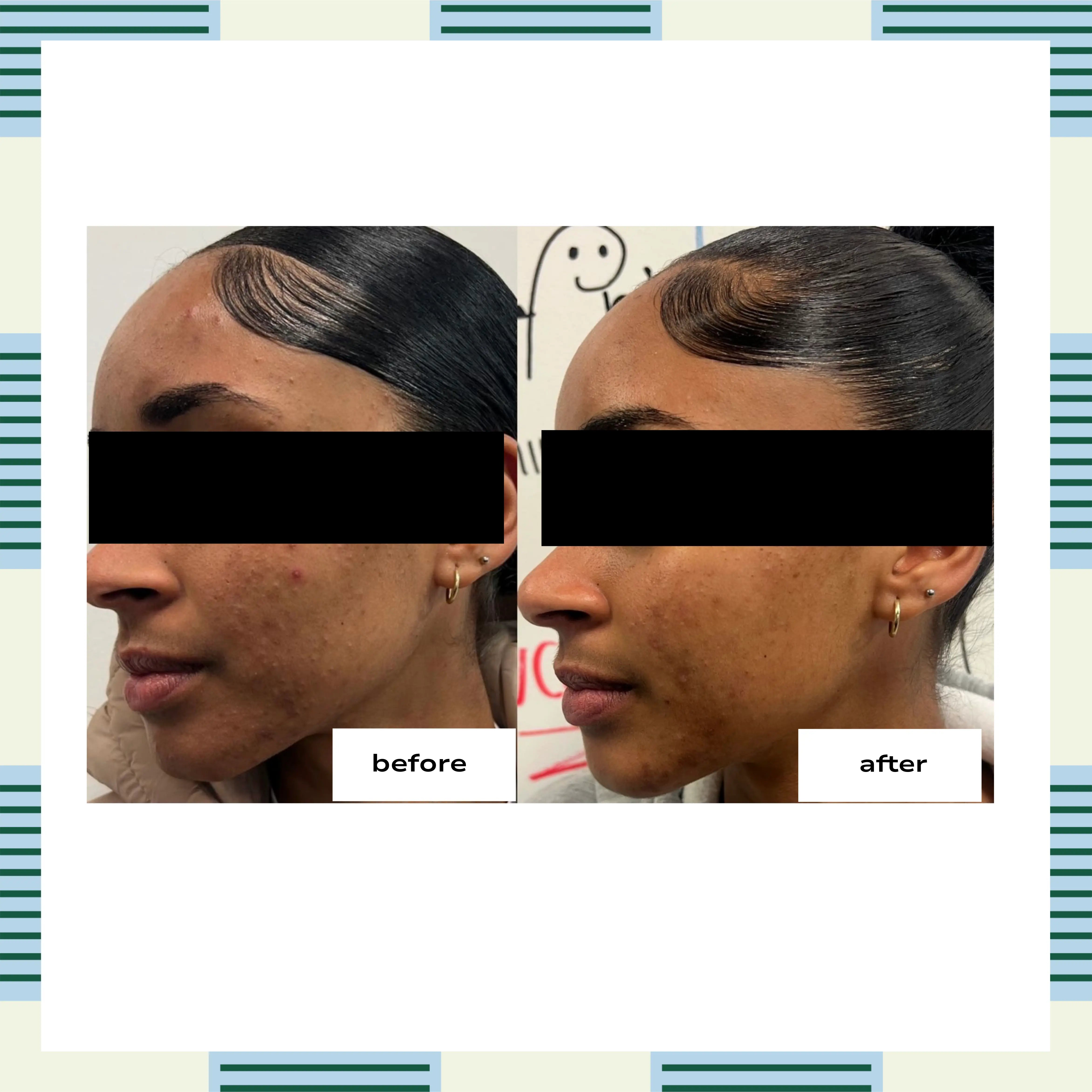 Glycolic Cleansing Gel, 120 ml