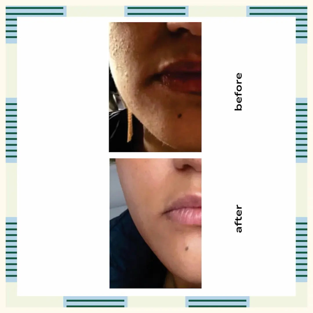 Glycolic Tonic | Exfoliator For Face and Body, 120 ml