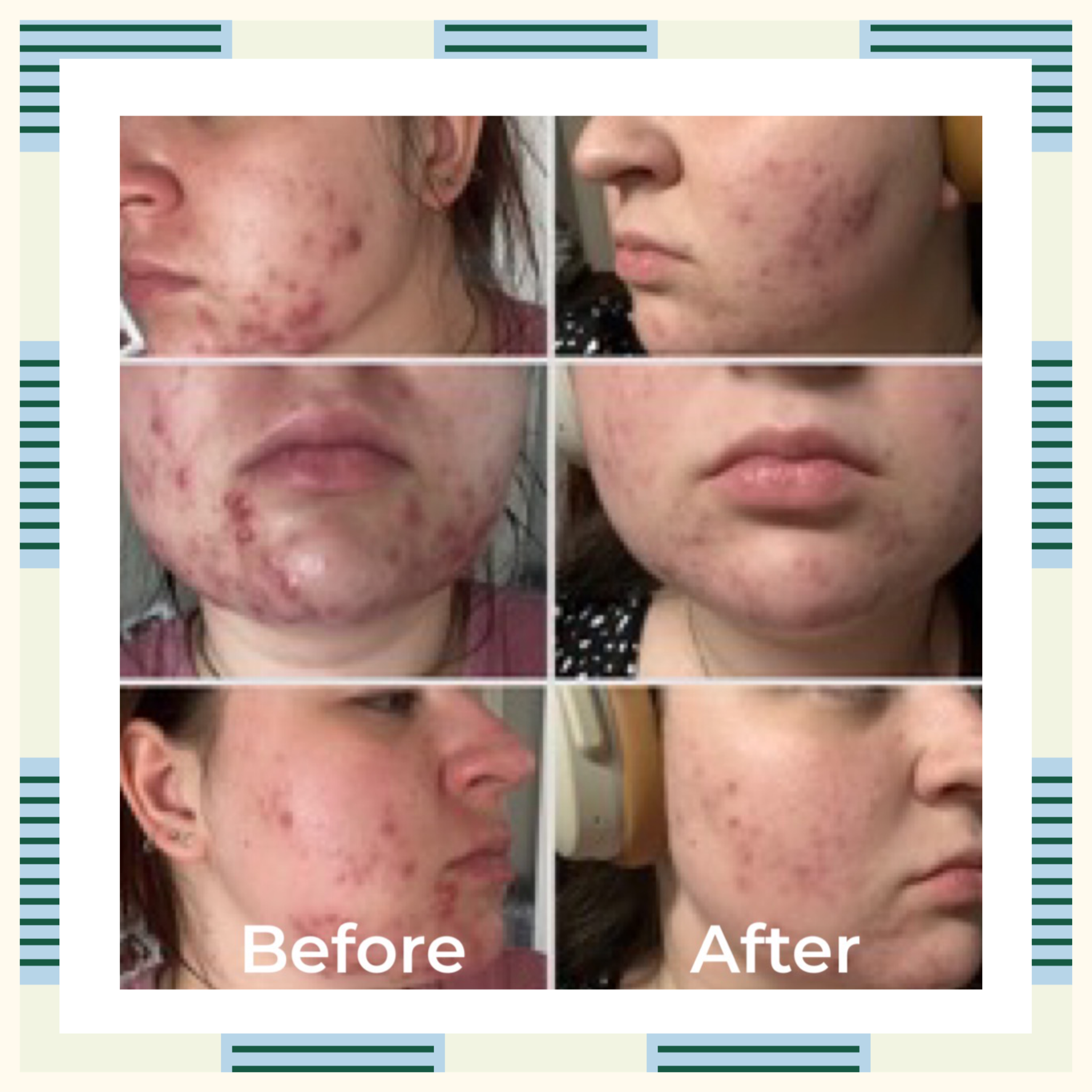 Oil Control Serum, 30 ml